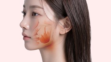 옆얼굴 여성 — 볼 안쪽 근막(SMAS) 층을 주황색으로 표시한 그림