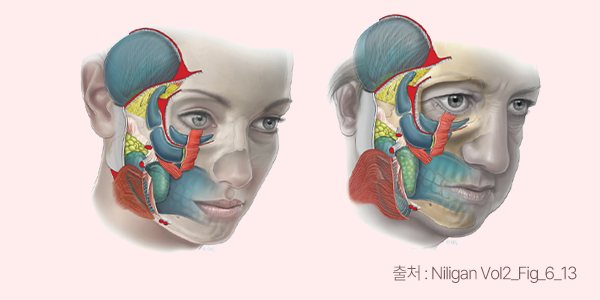 모든 얼굴에 같은 거상은 없습니다. — 출처 : Niligan Vol2_Fig_6_13
