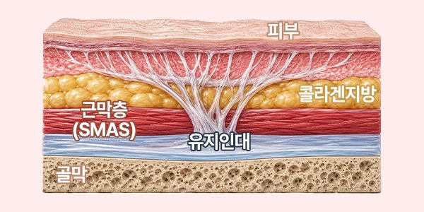 광범위한 유지인대 박리가 결과를 만듭니다. — 피부 · 콜라겐지방 · 근막층 (SMAS) · 유지인대 · 골막