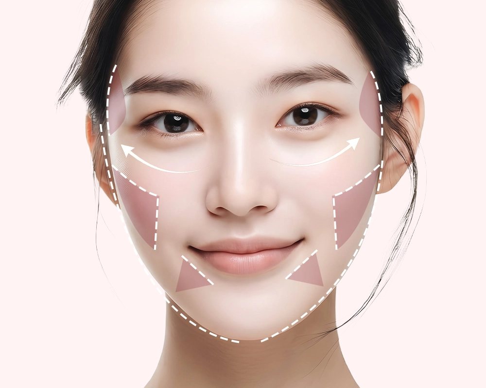 정면 여성 얼굴 — 관자·볼·턱 옆 분홍 면 표시와 얼굴 윤곽 점선(윤곽교정술 부위)